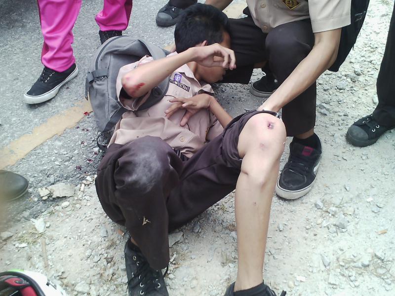 Lakalantas Terjadi Didepan Kantor Bupati