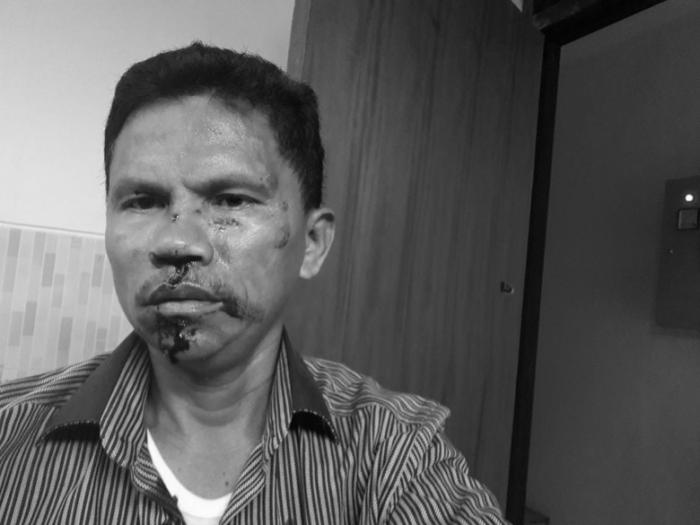 Anggota DPRD Ini 'Bonyok' Dikeroyok Gara-gara Meme Amien Rais-Rizieq