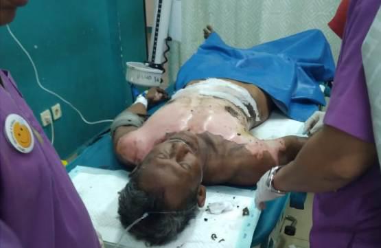 4 Warga Dumai Kesentrum Listrik, 1 Kritis