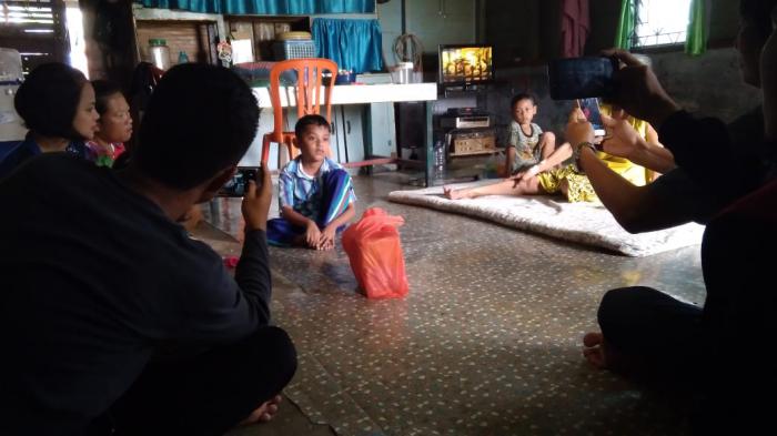 Idap Penyakit Langka, Bocah 9 Tahun di Selatpanjang Butuh Uluran Tangan
