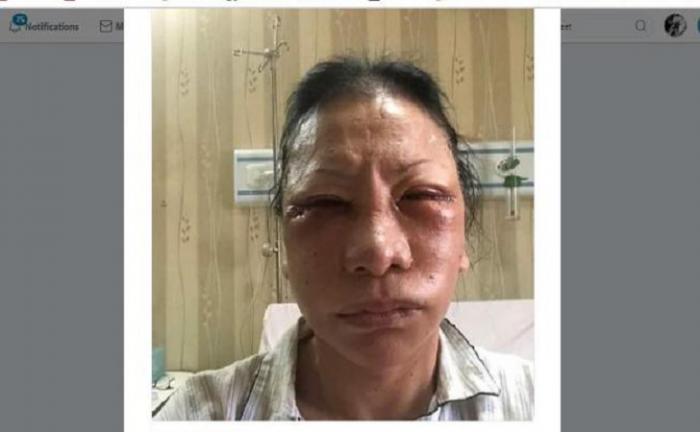 Babak Belur, Wajah Ratna Sarumpaet Bengkak Dipukuli Sejumlah Orang