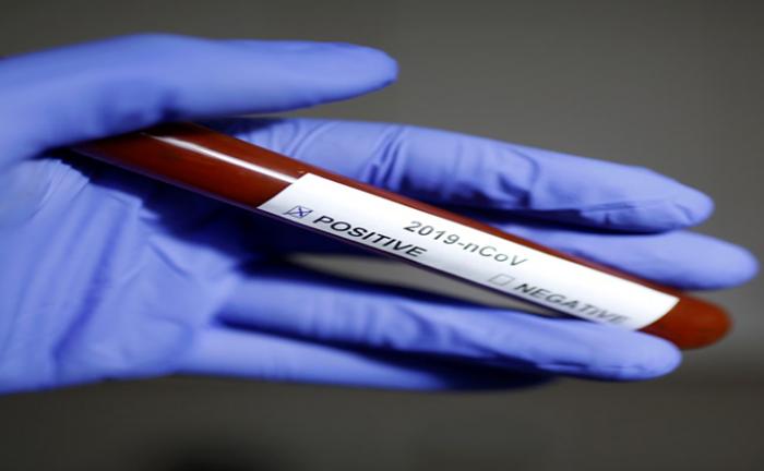 Kecamatan Mandau, Bengkalis Dominasi Penambahan Kasus Covid-19 di Bengkalis