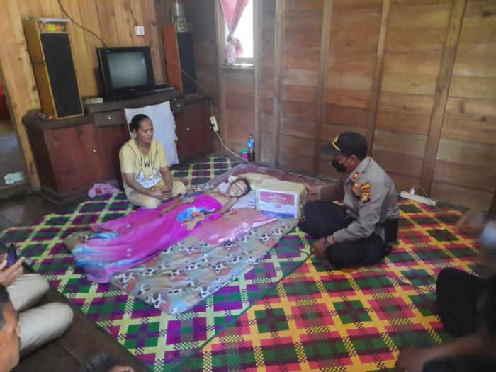 Bantu Ringankan Beban, Polsek Merbau Kunjungi Anak Penderita Hepatitis